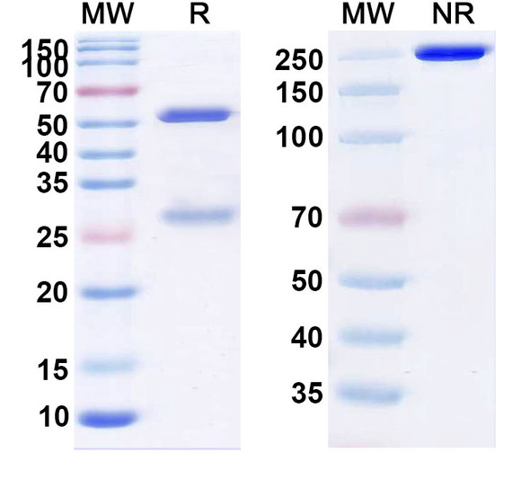 Anti-Clostridium perfringens CPE Recombinant Monoclonal Antibody (SAA2357) - SDS-PAGE