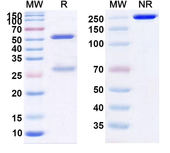 Anti-Clostridium perfringens CPE Recombinant Monoclonal Antibody (SAA2357) - SDS-PAGE