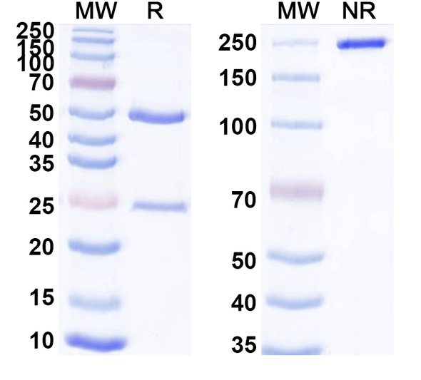 Anti-Human ANTXR1/TEM8 Recombinant Monoclonal Antibody (SAA2358) - SDS-PAGE