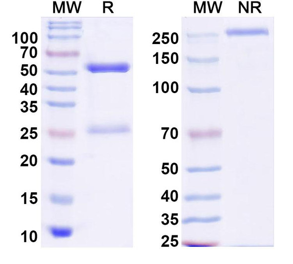 Anti-Mouse F4/80 Recombinant Monoclonal Antibody (CI:A3-1) - SDS-PAGE