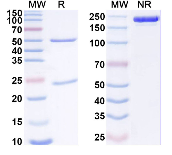 Anti-Monkeypox virus/MPXV A35R Recombinant Monoclonal Antibody (EV35-2) - SDS-PAGE