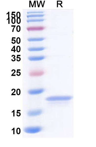 Anti-VACV G9 Recombinant Nanobody (SAA2379) - SDS-PAGE