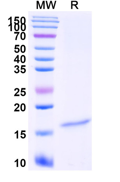 Anti-Candida albicans VRG4 Recombinant Nanobody (SAA2380) - SDS-PAGE