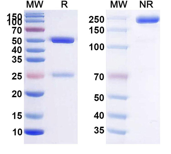 Anti-HPV6 L1/Major capsid protein L1 Recombinant Monoclonal Antibody (SAA2383) - SDS-PAGE