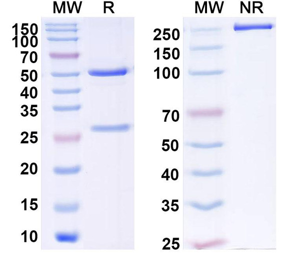 Anti-HPV18 L1/Major capsid protein L1 Recombinant Monoclonal Antibody (SAA2386) - SDS-PAGE