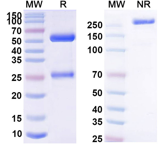 Anti-Human CD191/CCR1 Recombinant Monoclonal Antibody (SAA2405) - SDS-PAGE