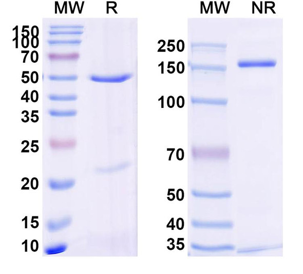 Anti-Human STEAP4 Recombinant Monoclonal Antibody (SAA2399) - SDS-PAGE