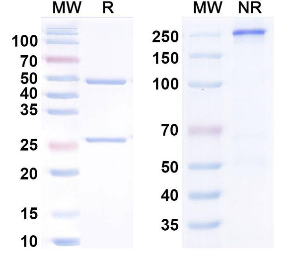Anti-IL1RL1/ST2 Antibody (TQC2938) Recombinant Monoclonal Antibody (TQC2938) - SDS-PAGE