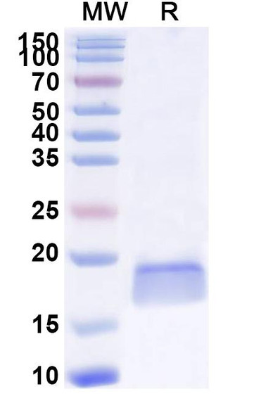 Anti-Clostridium botulinum botA/BoNT Recombinant Nanobody (F12) - SDS-PAGE