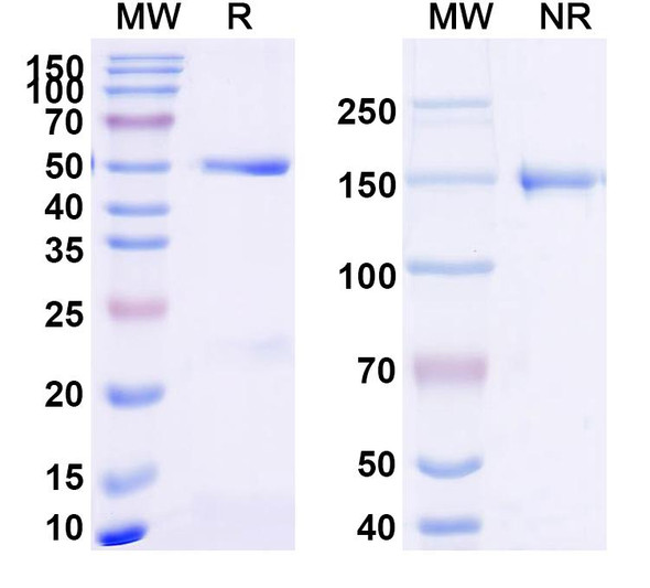 Anti-PBP2a Recombinant Monoclonal Antibody (SAA2417) - SDS-PAGE