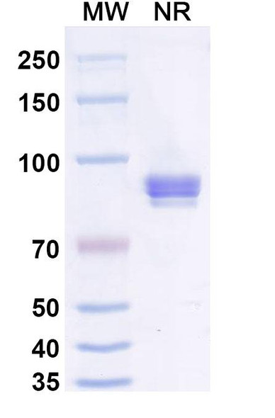 Anti-2,4-Dichlorophenoxyacetic acid/2,4-D Recombinant Monoclonal Antibody (SAA2419) - SDS-PAGE