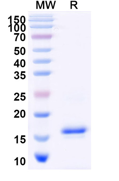 Anti-2,4-Dichlorophenoxyacetic acid/2,4-D Recombinant Nanobody (SAA2419) - SDS-PAGE