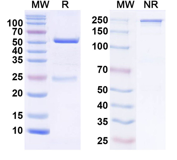 Anti-POTRA domain-containing protein/OMP Recombinant Monoclonal Antibody (SAA2421) - SDS-PAGE