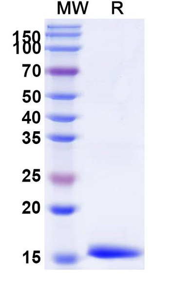 Anti-Dog TNFa/TNF-alpha Recombinant Nanobody (SAA2422) - SDS-PAGE