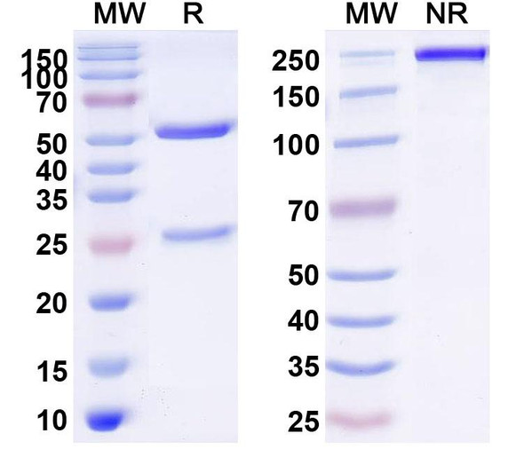 Anti-Borreliella burgdorferi ospA Recombinant Monoclonal Antibody (SAA2243) - SDS-PAGE