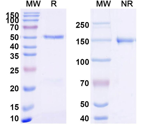 Anti-MAP3K2 (K260me3) Recombinant Monoclonal Antibody (SAA2423) - SDS-PAGE