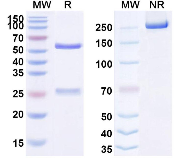 Anti-7-methylguanosine (m7G) Recombinant Monoclonal Antibody (SAA2426) - SDS-PAGE