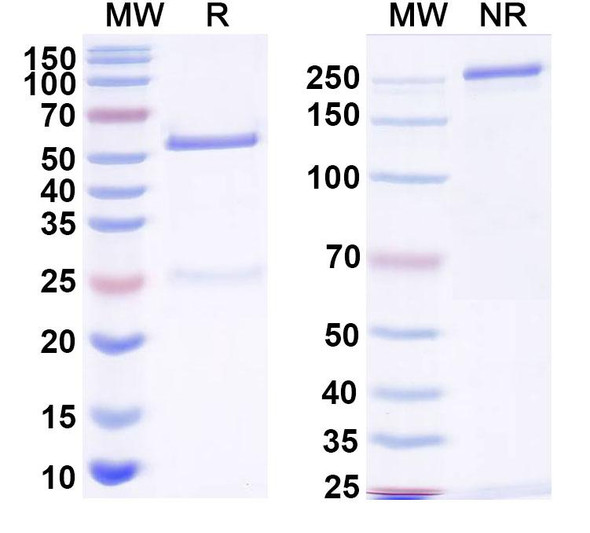 Anti-Monkeypox virus/MPXV M1R Recombinant Monoclonal Antibody (SAA2430) - SDS-PAGE