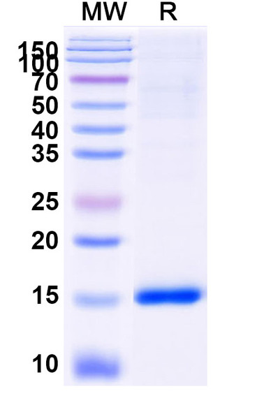 Anti-Human TRPC3 Recombinant Nanobody (SAA2431) - SDS-PAGE
