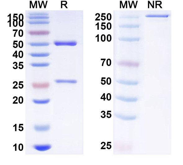 Anti-HPV18 E7/Protein E7 Recombinant Monoclonal Antibody (SAA2459) - SDS-PAGE