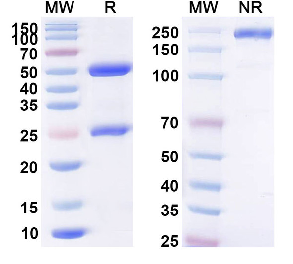 Anti-HPV31 E7/Protein E7 Recombinant Monoclonal Antibody (SAA2461) - SDS-PAGE