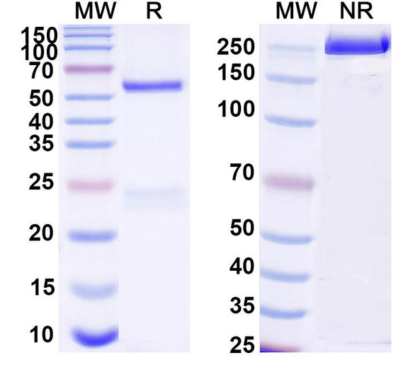 Anti-HPV35 E7/Protein E7 Recombinant Monoclonal Antibody (SAA2468) - SDS-PAGE