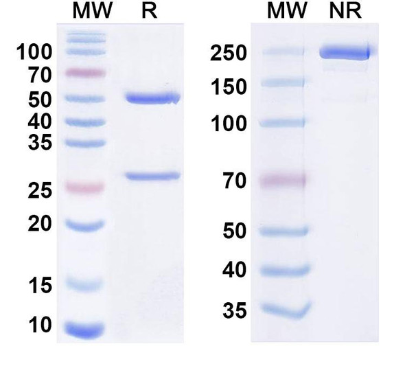 Anti-HPV59 E7/Protein E7 Recombinant Monoclonal Antibody (SAA2479) - SDS-PAGE