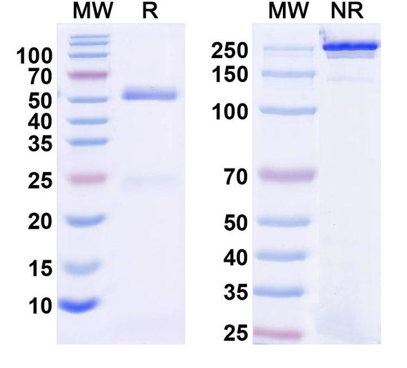 Anti-Mouse MARCO Recombinant Monoclonal Antibody (SAA2483) - SDS-PAGE