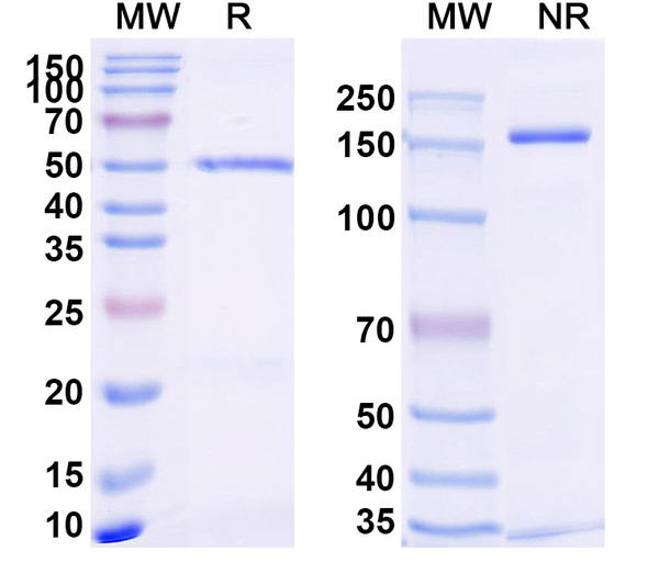 Anti-AAV5 VP1/Capsid protein VP1 Recombinant Monoclonal Antibody (SAA2449) - SDS-PAGE