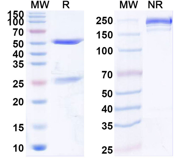 Anti-VSV G/Glycoprotein G Recombinant Monoclonal Antibody (8G5F11) - SDS-PAGE