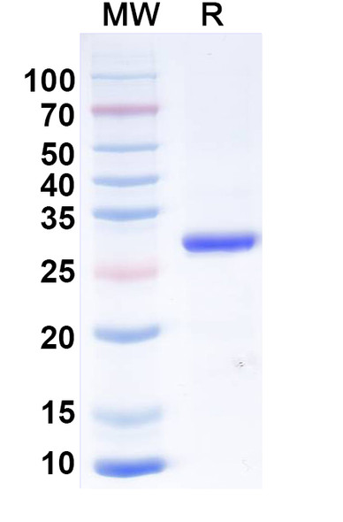 Anti-Human TNFa/TNF-alpha Recombinant Monoclonal Antibody (SAA2508) - SDS-PAGE