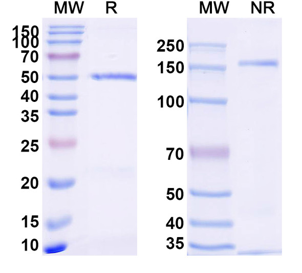 Anti-Human CD274/PD-L1/B7-H1 Recombinant Monoclonal Antibody (SP142) - SDS-PAGE