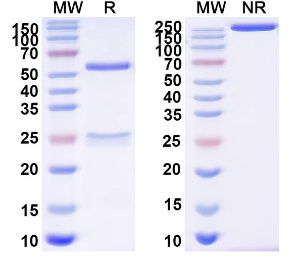 Anti-Human CD182/CXCR2 Recombinant Monoclonal Antibody (SAA2512) - SDS-PAGE