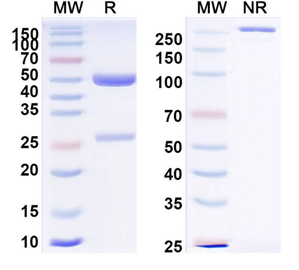 Anti-Hantaan virus/HTNV Glycoprotein N/Gn Recombinant Monoclonal Antibody (SAA2516) - SDS-PAGE