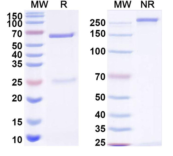 Anti-HSV Glycoprotein B/gB Recombinant Monoclonal Antibody (SAA2517) - SDS-PAGE
