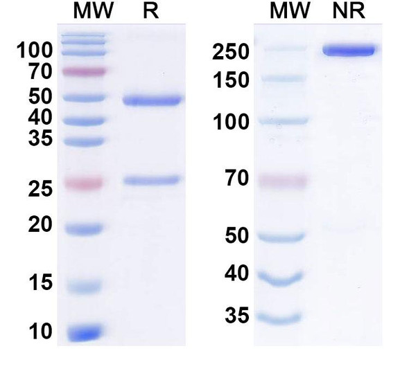 Anti-Human GREM1 Recombinant Monoclonal Antibody (Ab7326) - SDS-PAGE