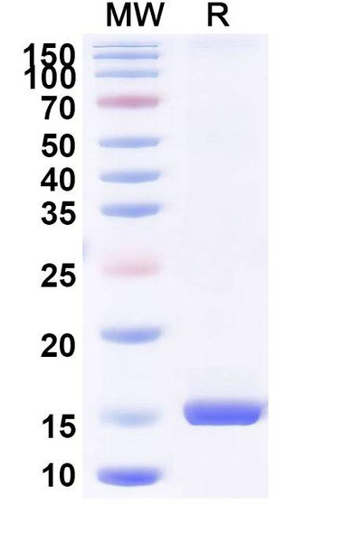 Anti-Human CD370/CLEC9A Recombinant Nanobody (SAA2549) - SDS-PAGE