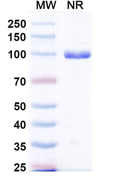 Anti-Mycobacterium tuberculosis icl1/Isocitrate lyase 1 Recombinant Monoclonal Antibody (SAA2568) - SDS-PAGE