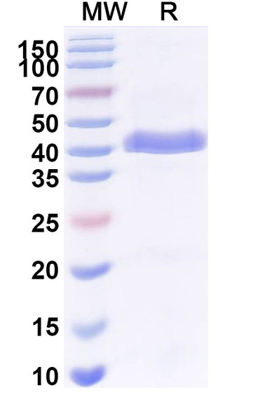 Anti-Human CD68/Macrosialin Recombinant Monoclonal Antibody (SAA2569) - SDS-PAGE