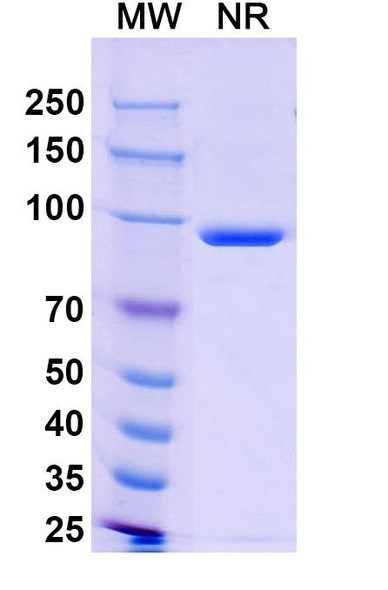 Anti-Human CD68/Macrosialin Recombinant Monoclonal Antibody (SAA2571) - SDS-PAGE