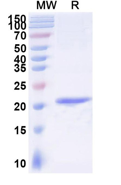 Anti-Human CD32b/FCGR2B Recombinant Nanobody (SAA2572) - SDS-PAGE