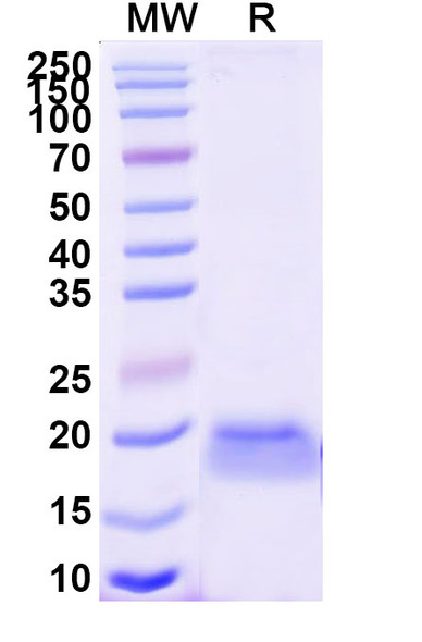 Anti-Human LGR4 Recombinant Nanobody (SAA2296) - SDS-PAGE