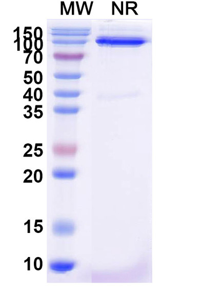 Anti-Oropouche virus/OROV Glycoprotein G1 Recombinant Nanobody (SAA2561) - SDS-PAGE