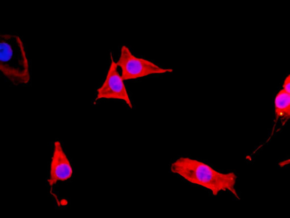 Recombinant beta actin Monoclonal Antibody (AGEL5321)