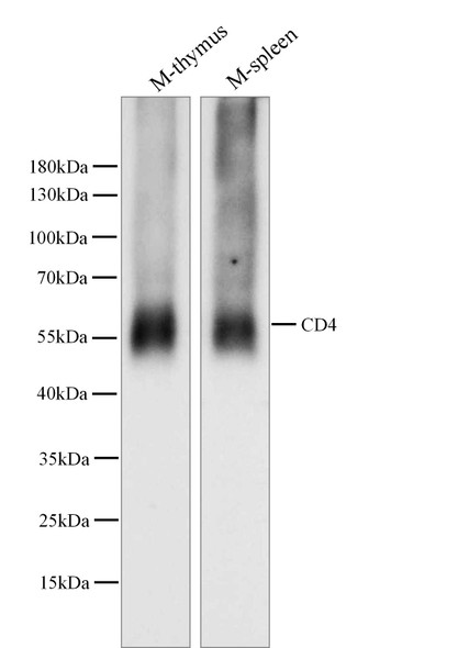 Recombinant CD4 Monoclonal Antibody (AGEL5322)
