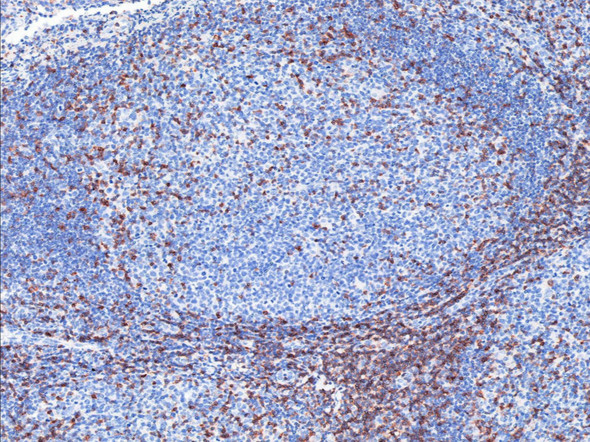 Recombinant CD5/Cluster of Differentiation 5 Monoclonal Antibody (AGEL5324)