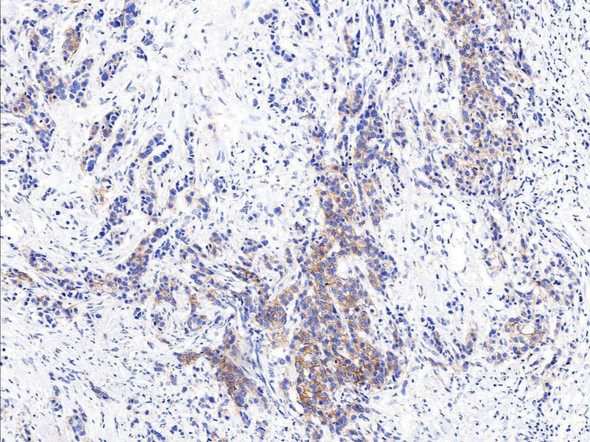 Recombinant HER2/ErbB2/CD340 Monoclonal Antibody (AGEL5325)