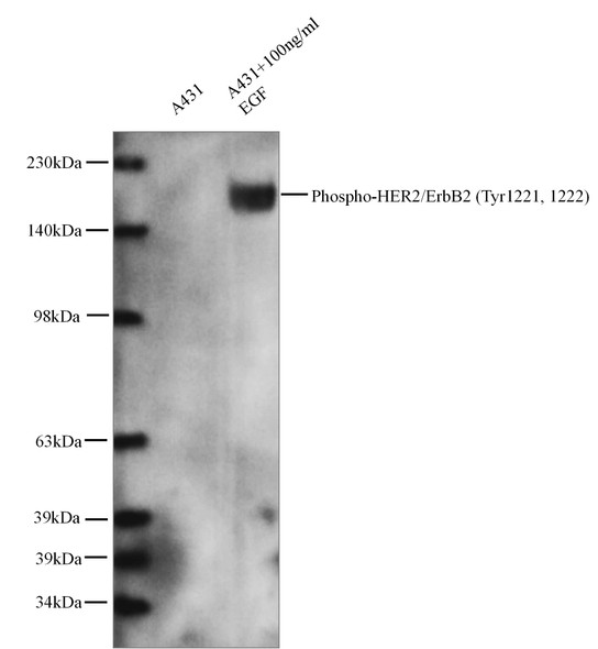 Recombinant Phospho-HER2/ErbB2 (Tyr1221, 1222) Monoclonal Antibody (AGEL5326)