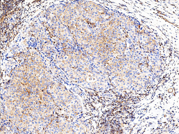 Recombinant Phospho-EGF Receptor (Tyr1068) Monoclonal Antibody (AGEL5330)