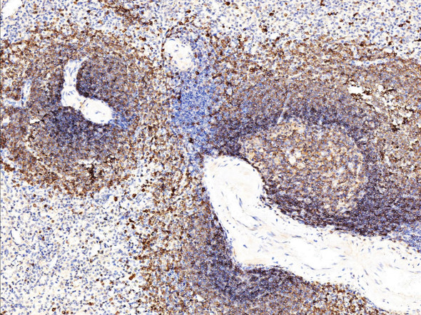 Recombinant CD22 Monoclonal Antibody (AGEL5334)